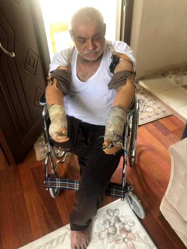 Başkan Şayir, kolunu ve bacağını kaybeden vatandaşın yüzünü güldürdü 